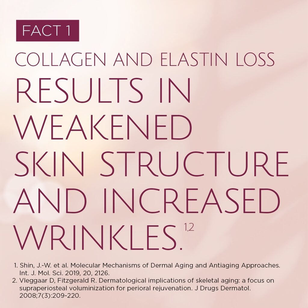 Sculptra Corrects Collagen Loss