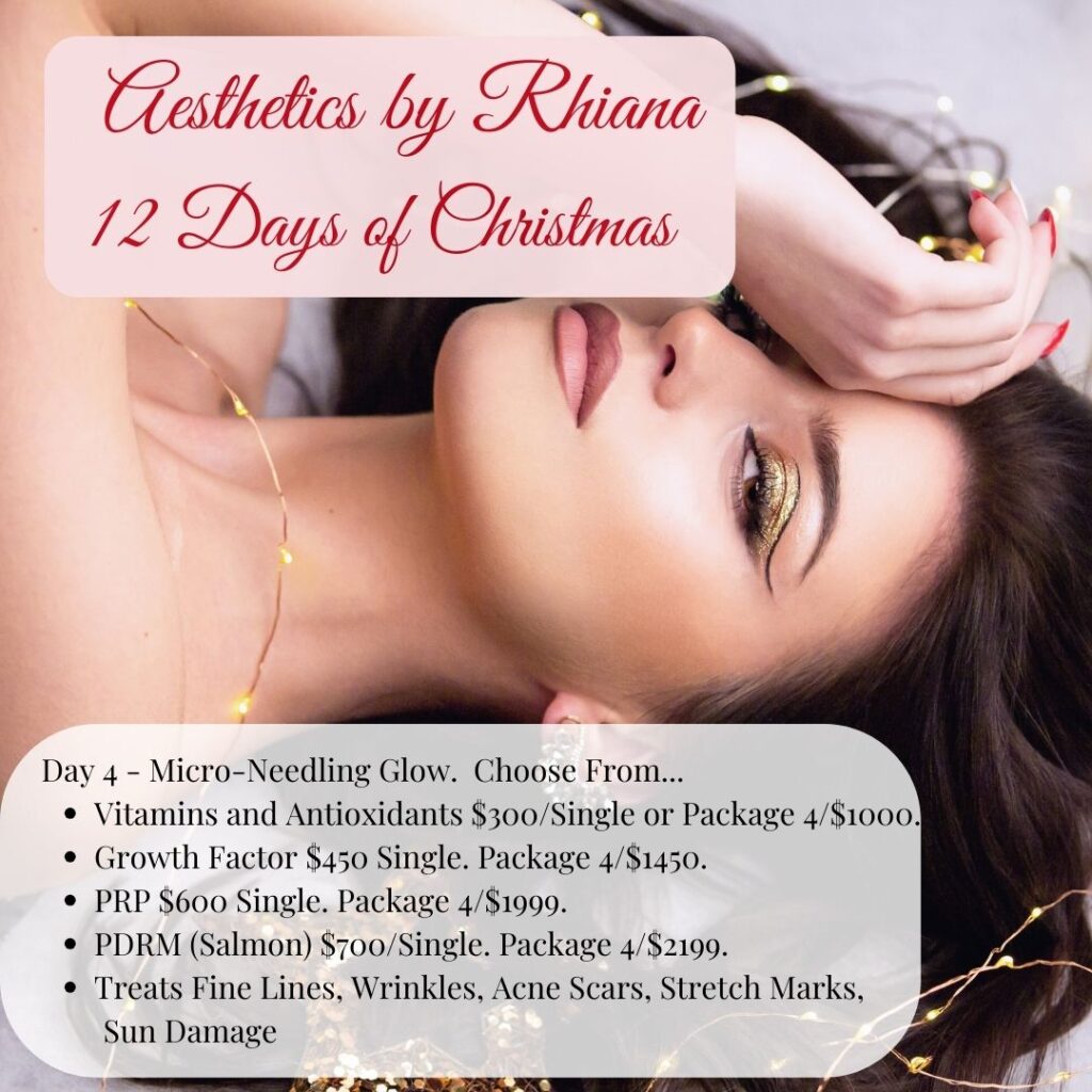 Day 4 Aesthetics By Rhiana 12 Days of Christmas